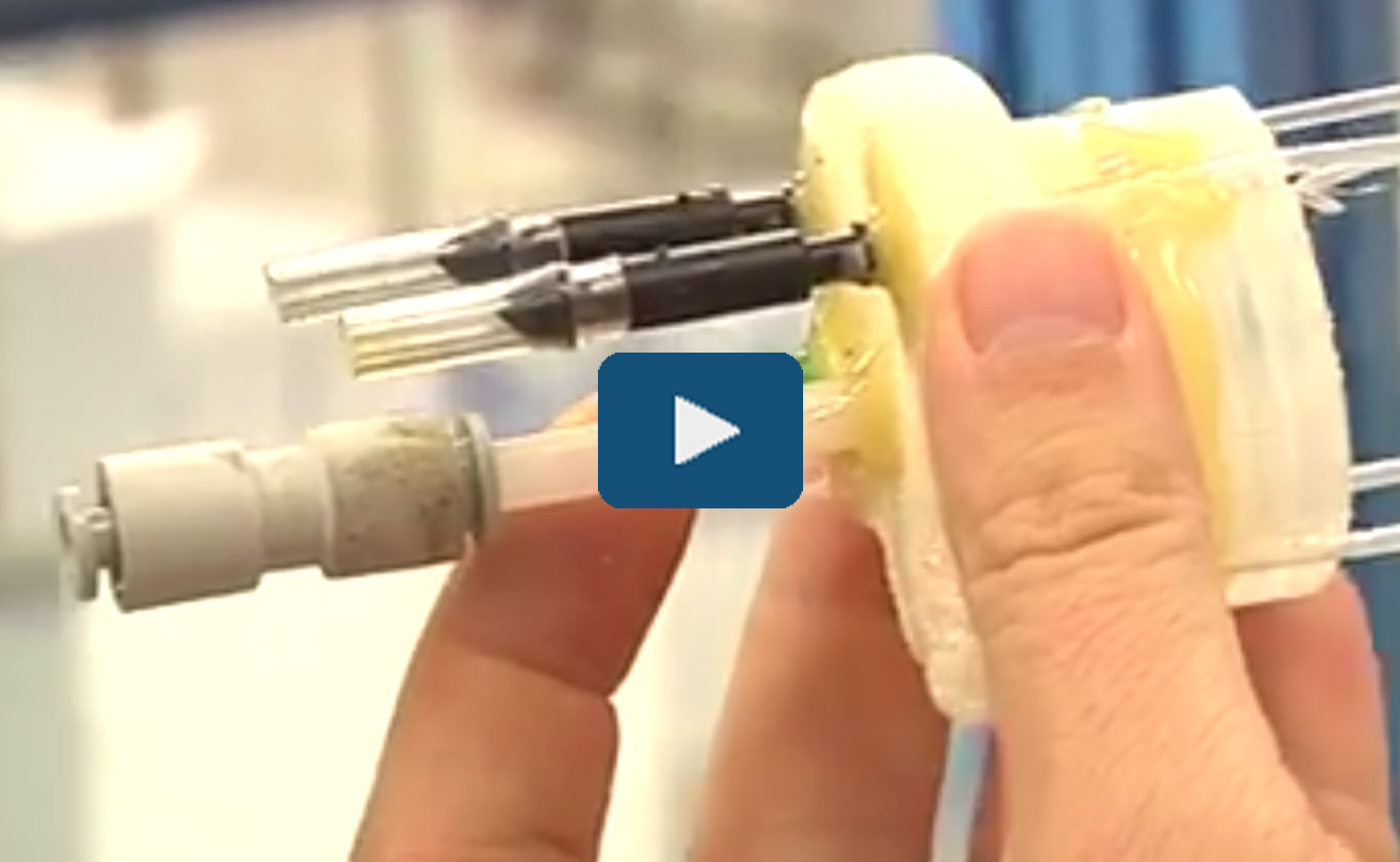 sistema trasplantes HDL