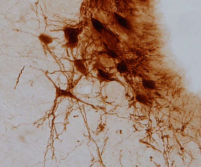 Neuronas-del-Locus-Coeruleus