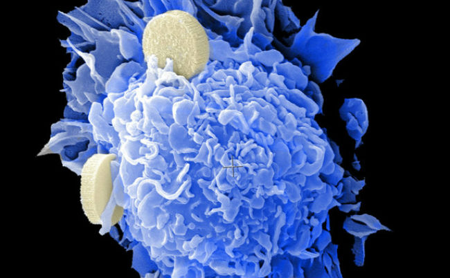 vacunas-contra-cancer