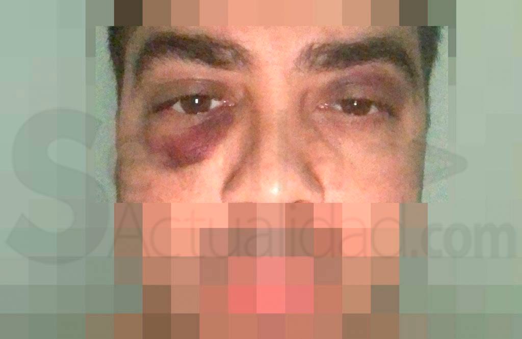 Aspecto que presentaba el alcalareño Antonio J.L. tras ser agredido por quince personas / SA