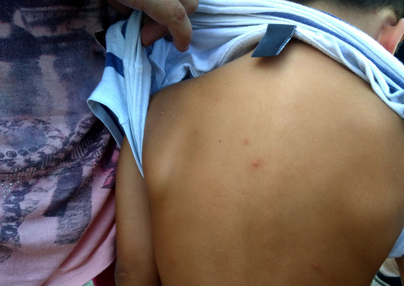 Afectados por pulgas /Participa Sevilla