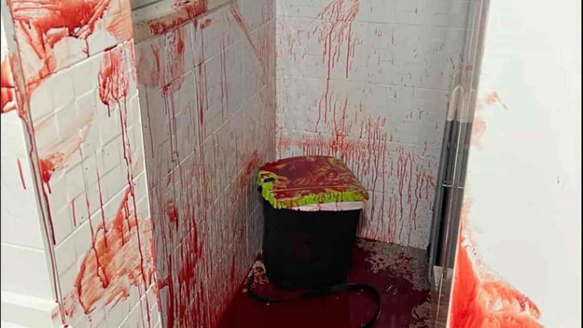 Sangre del corte en el antebrazo del joven