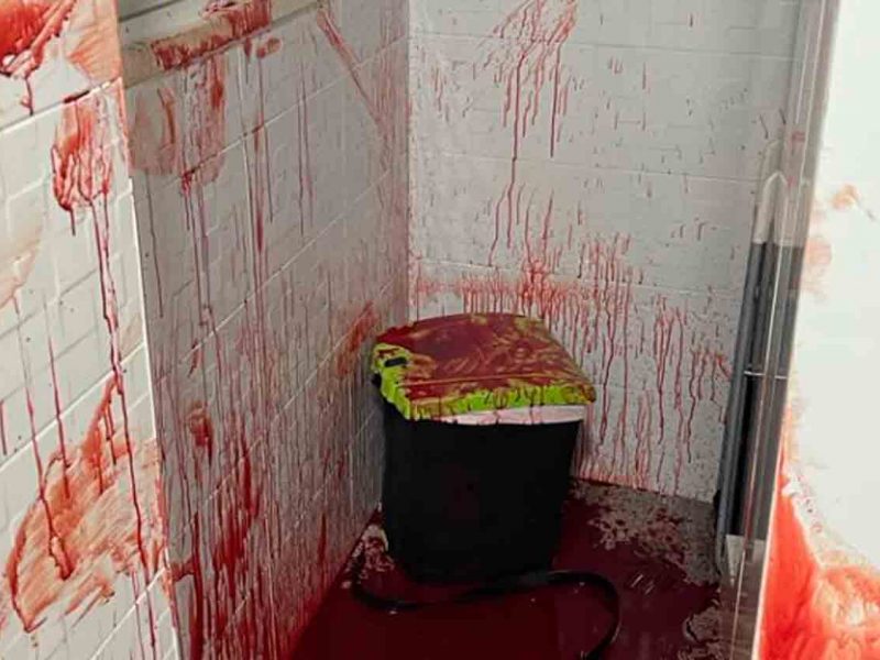 Sangre del corte en el antebrazo del joven