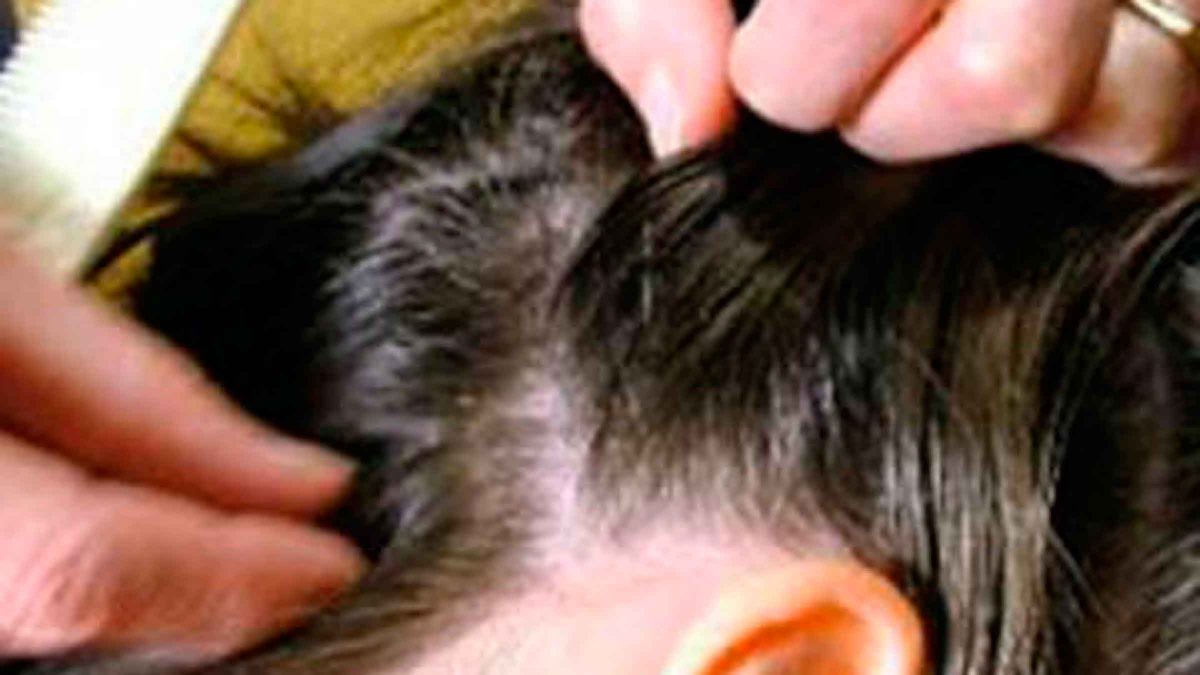 Imagen de un niño con piojos / Flickr