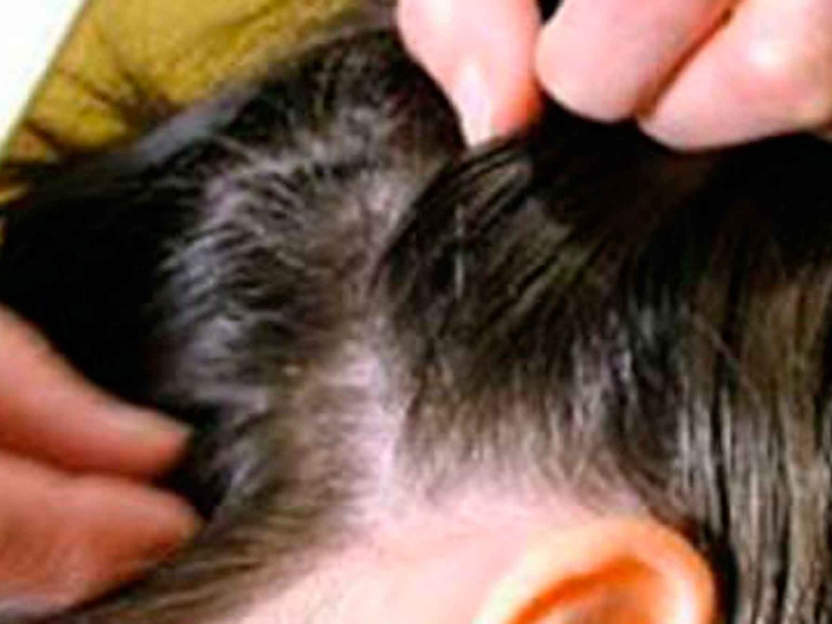 Imagen de un niño con piojos / Flickr