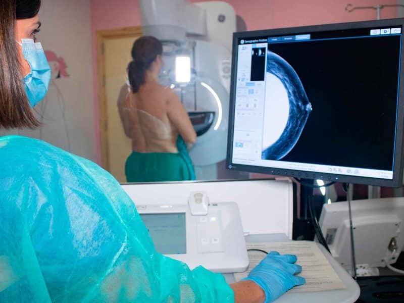 Imagen de un mamógrafo para detectar cáncer de mama en el Virgen del Rocío / SA