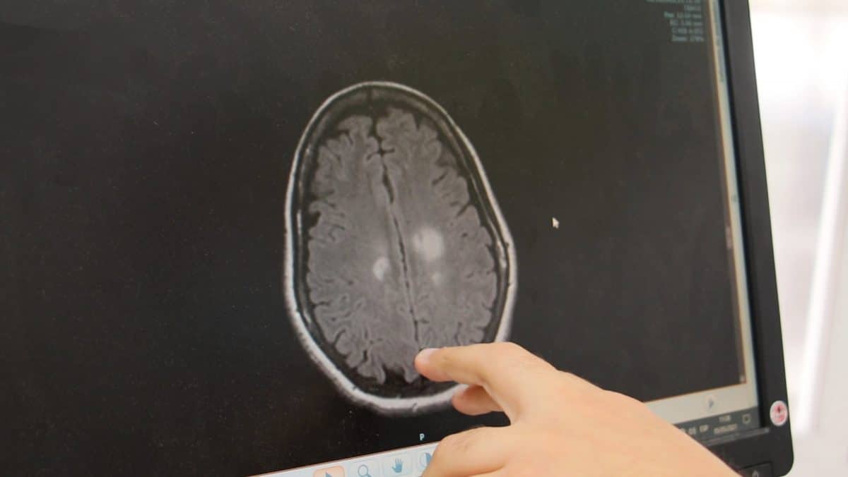 Diagnóstico neurológico por imagen