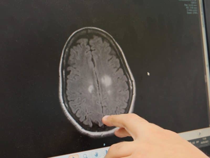 Diagnóstico neurológico por imagen