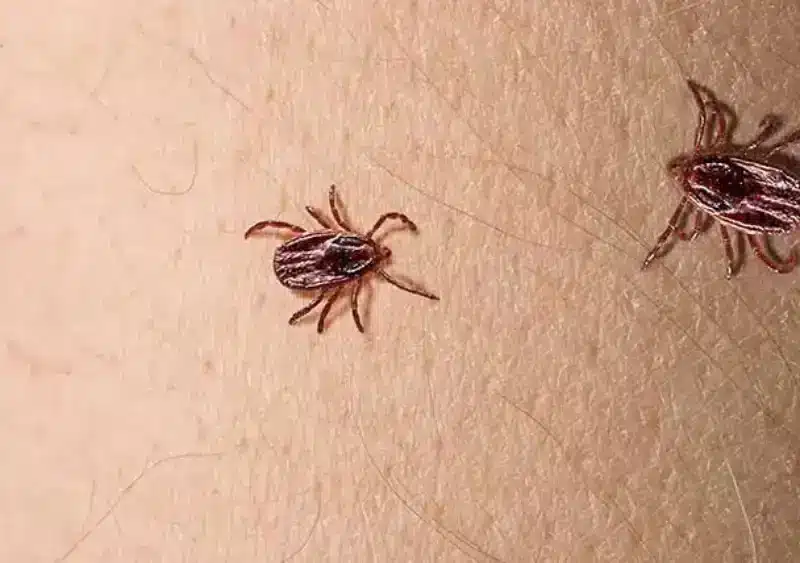 Imagen de una garrapata en piel humana. Fundación SOS Lyme