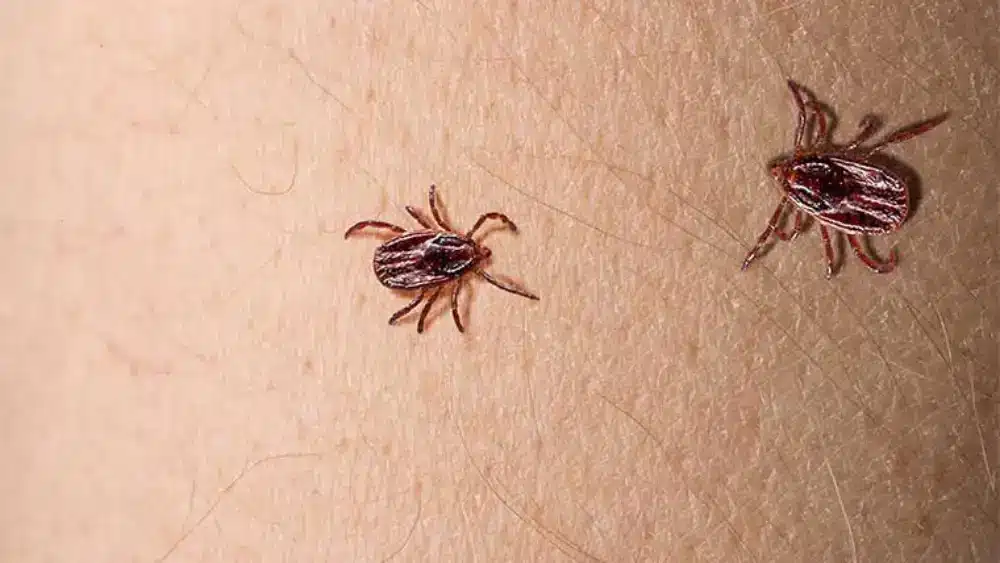 Imagen de una garrapata en piel humana. Fundación SOS Lyme