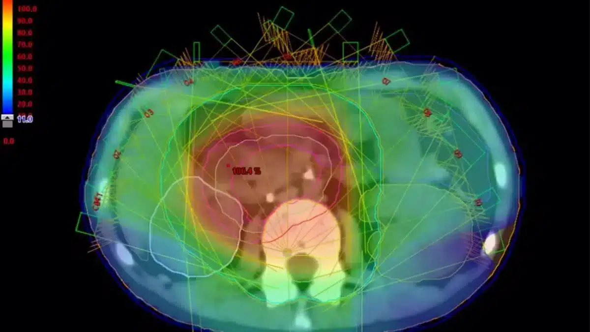 Imagen de recurso acerca de la investigación en cáncer infantil. - US