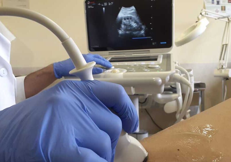 Personal facultativo realizando una ecografía. - HUVM