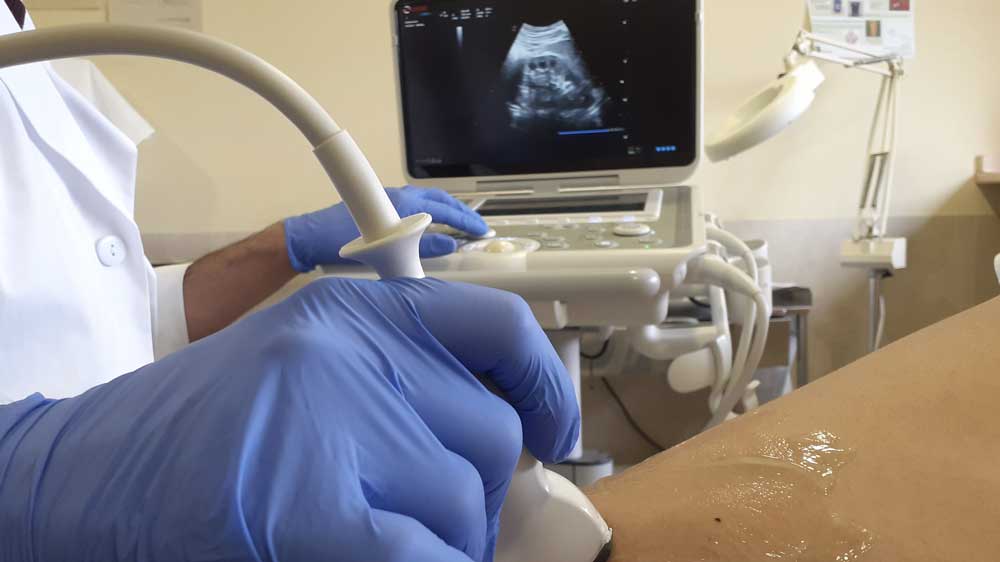 Personal facultativo realizando una ecografía. - HUVM
