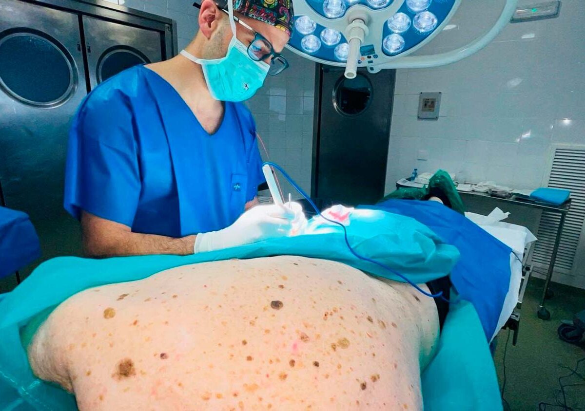 Intervención quirúrgica en el Hospital Virgen Macarena de Sevilla de un melanoma.- Hospital Virgen Macarena Sevilla