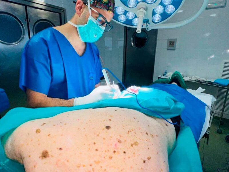 Intervención quirúrgica en el Hospital Virgen Macarena de Sevilla de un melanoma.- Hospital Virgen Macarena Sevilla